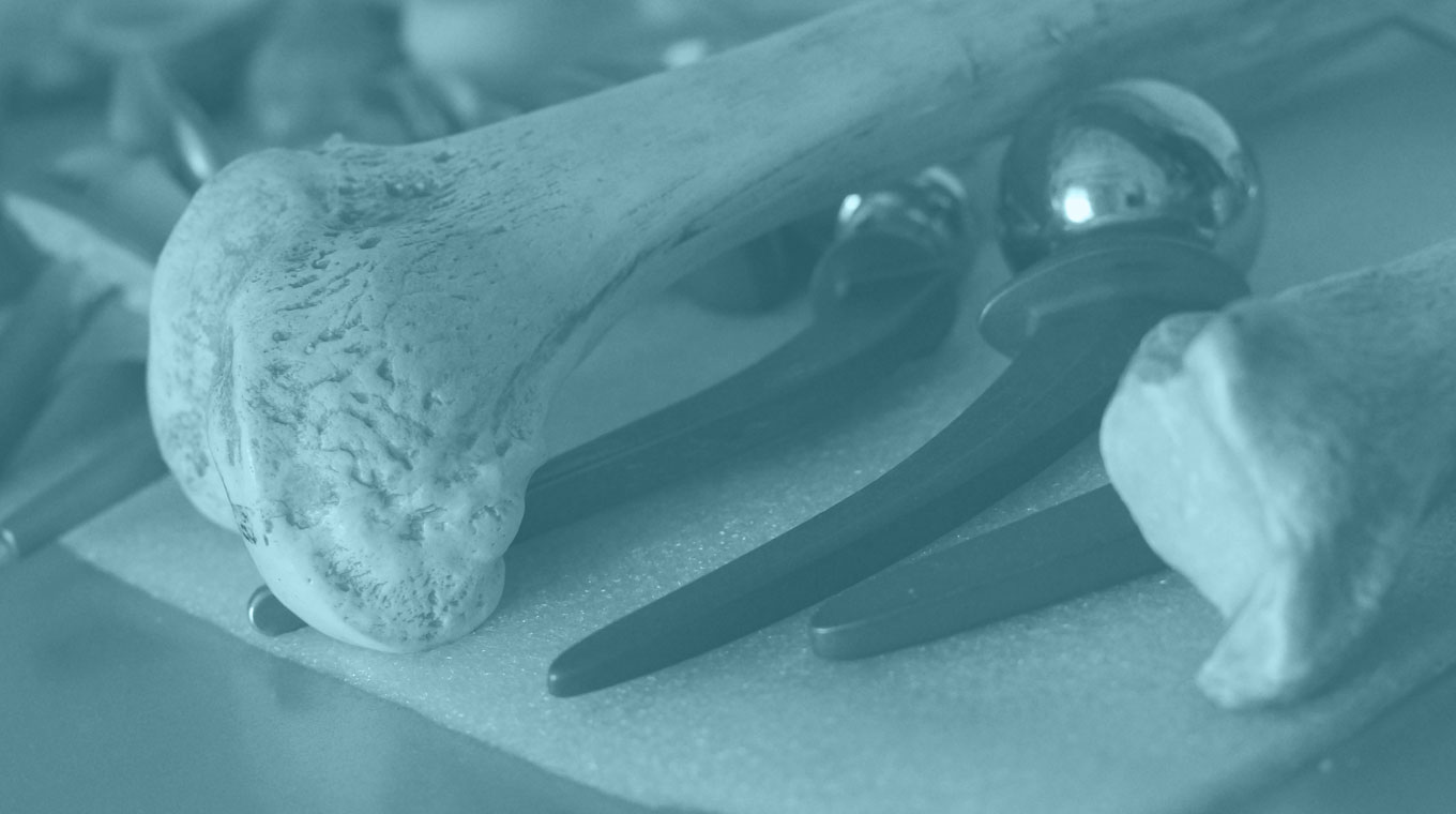 giorgio graziano ortopedico torino